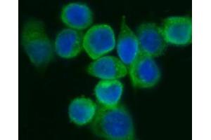 IF analysis of EIF5A using anti-EIF5A antibody (ABIN7602568).