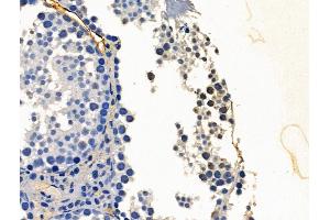 PHF8 Antibody at 1/100 staining Mouse testis tissue by IHC-P. (PHF8 Antikörper  (C-Term))