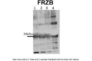 WB Suggested Anti-FRZB Antibody Titration: 0.
