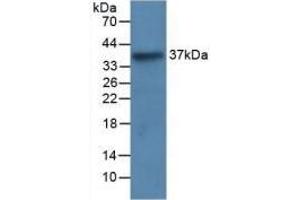 Detection of Recombinant LRG1, Human using Monoclonal Antibody to Leucine Rich Alpha-2-Glycoprotein 1 (LRG1) (LRG1 Antikörper  (AA 37-340))