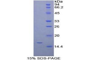 SDS-PAGE analysis of Mouse Synuclein gamma Protein.