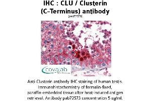 Image no. 1 for anti-Clusterin (CLU) (C-Term) antibody (ABIN1733163) (Clusterin Antikörper  (C-Term))