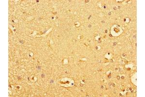 Immunohistochemistry of paraffin-embedded human brain tissue using ABIN7154928 at dilution of 1:100 (GUCY2C Antikörper  (AA 636-891))