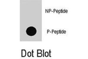 Dot blot analysis of BRAF (phospho T598) polyclonal antibody  on nitrocellulose membrane. (BRAF Antikörper  (pThr598))