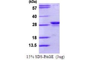 SDS-PAGE (SDS) image for Proteasome (Prosome, Macropain) Subunit, beta Type 10 (PSMB10) (AA 40-273) protein (His tag) (ABIN7279563)
