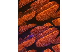 Immunofluorescence analysis of mouse skeletal muscle using α-Actin-1  Rabbit mAb (ABIN3015986, ABIN3015987, ABIN1680683 and ABIN1680684) at dilution of 1:100 (40x lens). (Actin Antikörper)