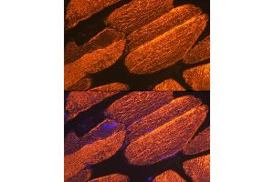 Immunofluorescence analysis of mouse skeletal muscle using α-Actin-1  Rabbit mAb (ABIN3015986, ABIN3015987, ABIN1680683 and ABIN1680684) at dilution of 1:100 (40x lens).