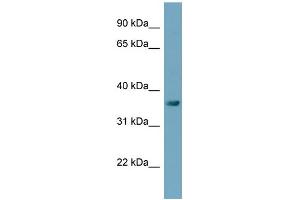 Western Blotting (WB) image for anti-TAM41, Mitochondrial Translocator Assembly and Maintenance Protein (TAMM41) (Middle Region) antibody (ABIN2783109)