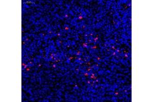 Immunofluorescence (Paraffin-embedded Sections) (IF (p)) image for anti-Caspase 3 (CASP3) (cleaved) antibody (ABIN7073336)