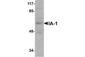 Western blot analysis of IA-1 in rat thymus tissue lysate with AP30396PU-N IA-1 antibody at 1 μg/ml. (INSM1 Antikörper  (N-Term))