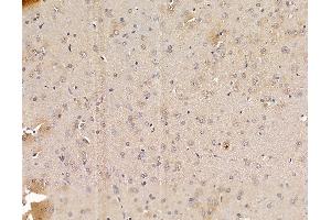 ABIN6265035 and ABIN6279859 at 1/100 staining rat brain tissue by IHC-P. (SFRS9 Antikörper  (Internal Region))