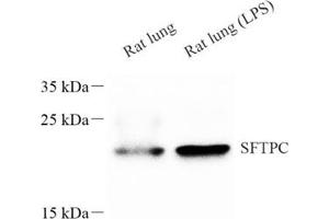 Western blot analysis of sftpc (ABIN7075216),at dilution of 1: 600 (Prosurfactant Protein C Antikörper)