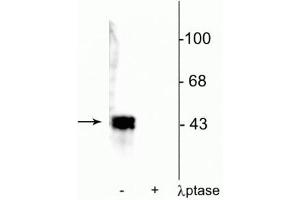 Western blot of human T47D cell lysate showing specific immunolabeling of ~42-44 kDa ERK/MAPK protein phosphorylated at Thr202/Tyr204 in the first lane (-).