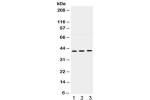 Western blot testing of 1) rat brain, 2) mouse brain and 3) human U87 lysate with HuD antibody. (HuD / ELAVL4 Antikörper)