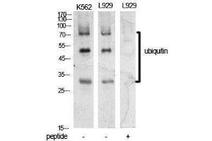 Western Blotting (WB) image for anti-Ubiquitin (Ubiquitin) (Internal Region) antibody (ABIN3181396) (Ubiquitin Antikörper  (Internal Region))