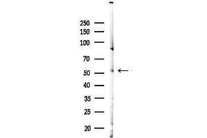 anti-Estrogen-Related Receptor alpha (ESRRA) (Internal Region) antibody
