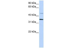 WB Suggested Anti-CLN6 Antibody Titration:  0. (CLN6 Antikörper  (C-Term))