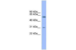 Western Blot showing PCSK2 antibody used at a concentration of 1-2 ug/ml to detect its target protein. (PCSK2 Antikörper  (Middle Region))