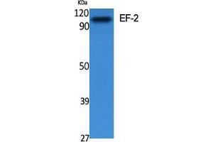 Western Blot (WB) analysis of specific cells using EF-2 Polyclonal Antibody. (EEF2 Antikörper  (Ser311))