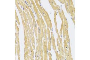 Immunohistochemistry of paraffin-embedded mouse heart using CSRP3 Antibody (ABIN6129258, ABIN6139141, ABIN6139143 and ABIN6222244) at dilution of 1:100 (40x lens). (CSRP3 Antikörper  (AA 1-194))