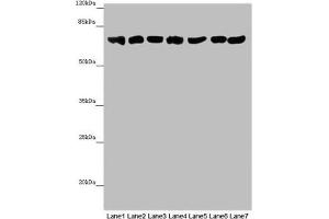 Western blot All lanes: EFHC1 antibody at 9. (EFHC1 Antikörper  (AA 391-640))