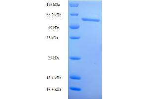 SDS-PAGE (SDS) image for FAD Synthetase (AA 1-490) protein (His-SUMO Tag) (ABIN5711696)