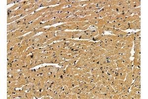 ABIN7095381 and ABIN7099438 at 1/100 staining rat heart tissue by IHC-P. (Endogenous retrovirus group 3 member 1 Env polyprotein (ERV3-1) Antikörper)