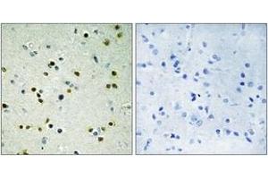 Immunohistochemistry analysis of paraffin-embedded human brain, using JHD3B Antibody. (JHD3B Antikörper  (AA 351-400))