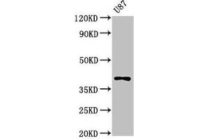 Western Blot Positive WB detected in: U87 whole cell lysate All lanes: OPN1SW antibody at 3 μg/mL Secondary Goat polyclonal to rabbit IgG at 1/50000 dilution Predicted band size: 40 kDa Observed band size: 40 kDa