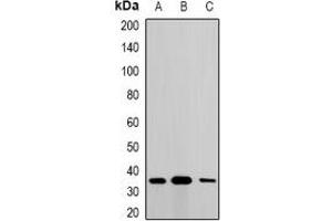 Western blot analysis of Metaxin-1 expression in A549 (A), SKOV3 (B), mouse liver (C) whole cell lysates. (Metaxin 1 Antikörper)
