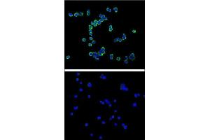 Confocal immunofluorescent analysis of C antibody  with R cell (above) compared with Jurkat as negative cell line (below). (Syndecan 1 Antikörper)