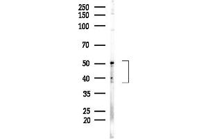 anti-Tissue Specific Transplantation Antigen P35B (TSTA3) (Internal Region) antibody