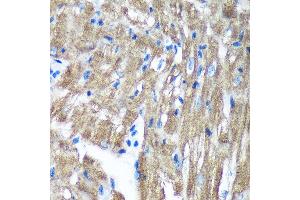 Immunohistochemistry of paraffin-embedded Mouse heart using TIMMDC1 Rabbit pAb (ABIN7270929) at dilution of 1:100 (40x lens). (TIMMDC1 Antikörper  (AA 206-285))