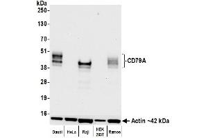 Western Blotting (WB) image for anti-B-cell antigen receptor complex-associated protein alpha chain (CD79A) (AA 33-143) antibody (ABIN7453962)