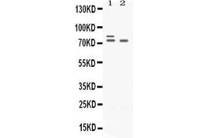 Western blot analysis of Plzf expression in rat ovary extract ( Lane 1) and SKOV3 whole cell lysates ( Lane 2).