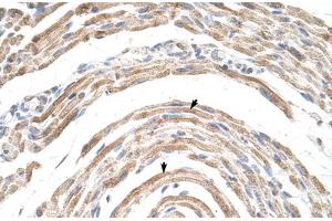 Immunohistochemical staining (Formalin-fixed paraffin-embedded sections) of human muscle with CPSF6 polyclonal antibody . (CPSF6 Antikörper  (AA 261-310))