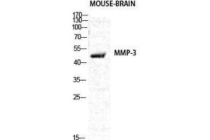 Western Blotting (WB) image for anti-Matrix Metallopeptidase 3 (Stromelysin 1, Progelatinase) (MMP3) (C-Term) antibody (ABIN3187103)