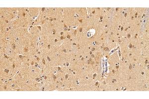 Detection of MAP1LC3a in Human Cerebrum Tissue using Polyclonal Antibody to Microtubule Associated Protein 1 Light Chain 3 Alpha (MAP1LC3a) (MAP1LC3A Antikörper  (AA 1-120))