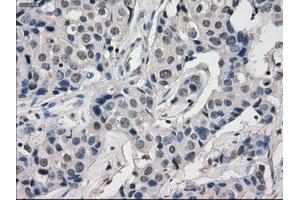 Image no. 3 for anti-Budding Uninhibited By Benzimidazoles 1 Homolog beta (Yeast) (BUB1B) antibody (ABIN1496995) (BUB1B Antikörper)