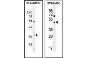 Western blot analysis in mouse bladder tissue (left) and NCI-H460 cell line (right) lysates  (35ug/lane) using CL029 antibody (N-term) Cat. (C12ORF29 Antikörper  (N-Term))