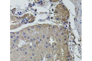 Immunohistochemistry of paraffin-embedded Human stomach using UBE2S Polyclonal Antibody at dilution of 1:100 (40x lens). (UBE2S Antikörper)