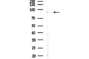 anti-Progesterone Immunomodulatory Binding Factor 1 (PIBF1) (C-Term) antibody