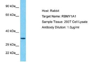 Host: Rabbit Target Name: RBMY1A1 Sample Tissue: Human 293T Whole Cell Antibody Dilution: 1ug/ml (RBMY1A1 Antikörper  (C-Term))
