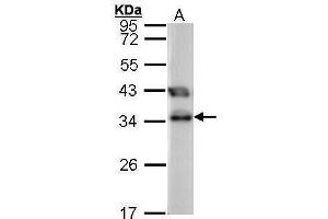 WB Image Sample (30 ug of whole cell lysate) A: 293T 12% SDS PAGE antibody diluted at 1:1000 (TTC1 Antikörper)