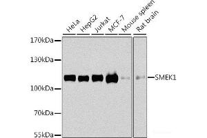 SMEK1 anticorps