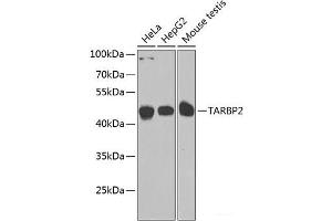 Western blot analysis of extracts of various cell lines using TARBP2 Polyclonal Antibody at dilution of 1:1000. (TARBP2 Antikörper)