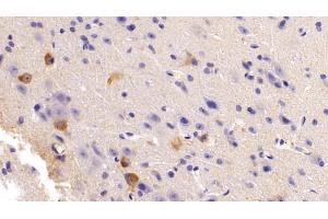 Detection of NOS1 in Mouse Cerebrum Tissue using Polyclonal Antibody to Nitric Oxide Synthase 1, Neuronal (NOS1)