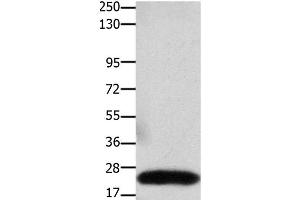 Western Blot analysis of Human colon cancer tissue using Claudin 3 Polyclonal Antibody at dilution of 1:550 (Claudin 3 Antikörper)