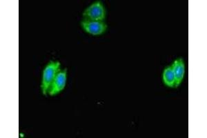 Immunofluorescent analysis of HepG2 cells using ABIN7169234 at dilution of 1:100 and Alexa Fluor 488-congugated AffiniPure Goat Anti-Rabbit IgG(H+L) (WNK4 Antikörper  (AA 828-1106))