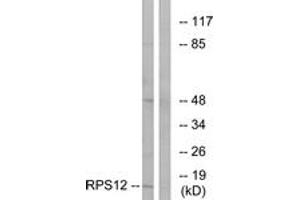 Western blot analysis of extracts from COLO cells, using RPS12 Antibody.
